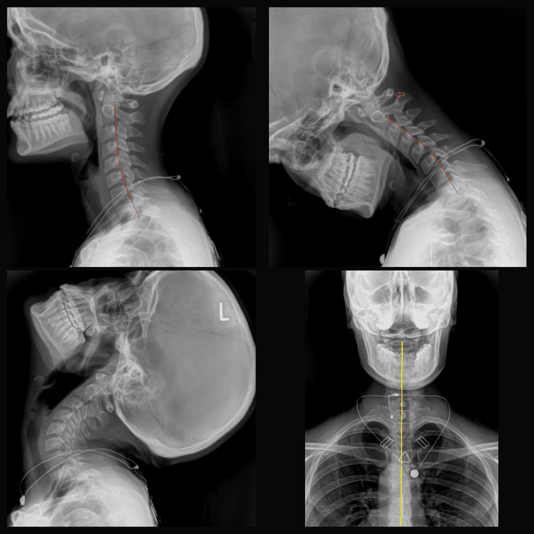 What Dr. Marie's Spine and Nervous System Looks Like? Foundation